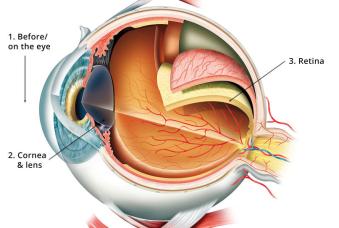 Ophtalmology SwissOptic